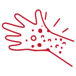rash-150x150